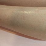 مطب لیزر موهای زائد لیورا