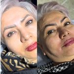 کلینیک تخصصی زیبایی و لیزر ویان