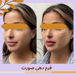 مرکز لیزر مرکز زیبایی دکتر مهسا رحیمی