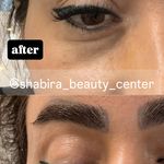 مطب پوست، مو و زیبایی و لیزر شبیرا