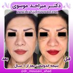 دکترمیراحدموسوی