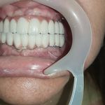مطب ایمپلنت دکتر نیما شفیعی