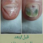 پدیکور و پودولوژیSD