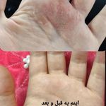 محصولات نیوشاومزاج شناسی دهقانی