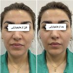 کلینیک پوست و مو بلانژ