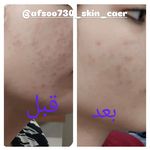 اتاق پوست فیشیال وزیبایی  افسانه