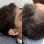 کلینیک زیبایی بلک ساوه