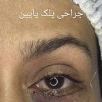 کلینیک زیبایی الماس کاملا اقساطی
