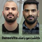 کلینیک زیبایی بلژو