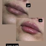 کلینیک زیبایی لاغری لیزر دانا