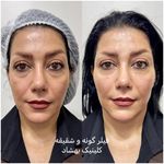 کلینیک تخصصی لیزر ،پوست و‌زیبایی بهشاد
