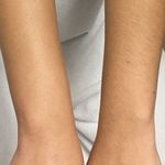 کلینیک پوست و مو و لیزر آتن