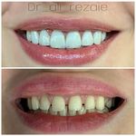 دندانپزشکی دیجیتال نویامِد