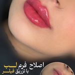 کلینیک لیزر و زیبایی مهسان