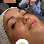 سالن پاکسازی پوست وفیشیال صورت زیبارو