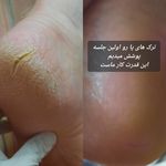 سالن اپیلاسیون نیره - آمل - 3361