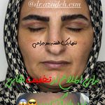 کلینیک زیبایی و لیزر دکتر آزاده اسماعیلی