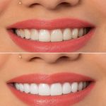 مطب دندانپزشکی دکتر فروتنی