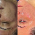 خدمات تخصصی فیشیال آیسو