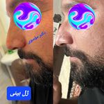 کلینیک زیبایی بوتاکس لیزر فیلر شجاعی