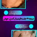 فیشیال و پاکسازی پوست مریم