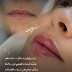 مطب پوست زيبايی ليزر دکتر شاه نعمت الهی