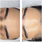 مژگان اسکین کرMojgan skincare