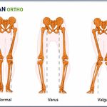 ویان ارتو مرکز تخصصی اسکن کف پا وکفی طبی