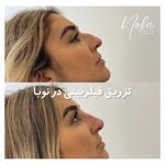 کلینیک زیبایی و لیزر مو زائد نوبا