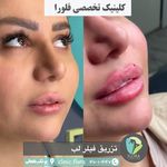 مجموعه زیبایی فلورا پوست مو زیبایی