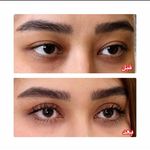 بلفاروپلاستی دکتر سیدمحمدرضا حسینی