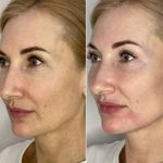 کلینیک پوست و زیبایی ژیلاوَش