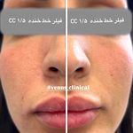 کلینیک پوست مو لیزر ونوس