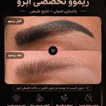 آرایش دائم، میکروپیگمنت، شید لب، خط چشم