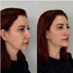 کلینیک پوست و زیبایی ژیلاوَش