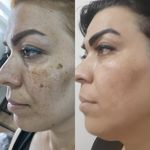 Skincar.azar فیشیال