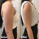 کلینیک تخصصی لاغری موضعی ولافیت