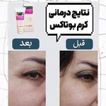 محصولات پوستی و آرایشی پرویزی