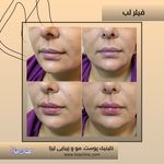 کلینیک زیبایی لیزا