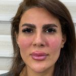 کلینیک تخصصی زیبایی و لیزر ویان