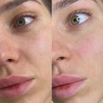 کلینیک پوست و زیبایی ژیلاوَش