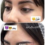 کلینیک زیبایی و جوانسازی پوست و مو الین