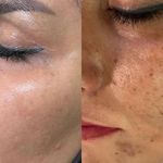 مژگان اسکین کرMojgan skincare