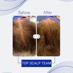 اولین مرکز میکرواسکالپ مشهد تاپ اسکالپ