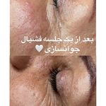مرکز تخصصی فیشال و پاکسازی پوست حنانه