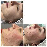 مرکز فیشال پوست و زیبایی نازنین وحدت