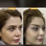 کلینیک زیبایی الماس کاملا اقساطی