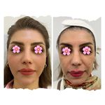 کلینیک زیبایی هانا