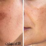 مرکز مشاورتخصصی پوست مو و فیشیالیست