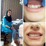 دندانپزشک دینا شعاعی